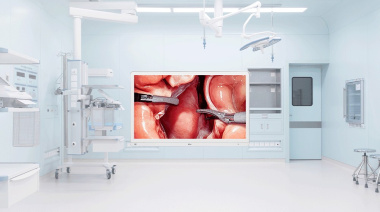 LG presenta su nuevo monitor quirúrgico 4K: claridad, eficiencia y respaldo automático