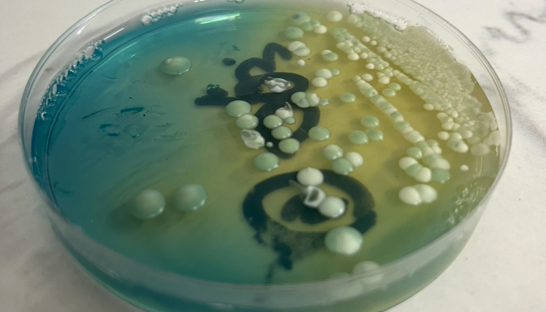 Levaduras nativas: la carta secreta de Argentina para ganar terreno en el mercado vitivinícola global