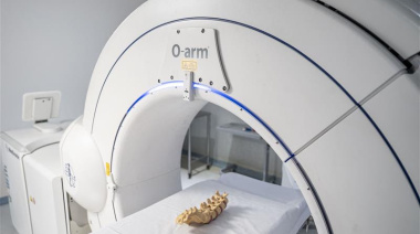 Córdoba incorpora un scanner móvil 3D y navegación avanzada para cirugías de alta precisión